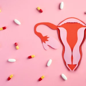 Bezpieczne odstawienie tabletek antykoncepcyjnych - PCOS